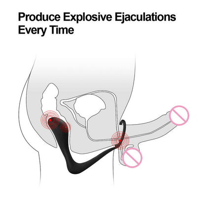 Anal Plug นวดต่อมลูกหมากชาย ห่วงรัดองคชาต ปลั๊กทวารเทียม Dildo G-Spot อุปกรณ์เสียบทวาร ของเล่นสำหรับผู้ใหญ่ ของเล่นทางทวารสำหรับผู้หญิง ผู้ชาย เกย์ ร้านค้าเซ็กซ์ทอย