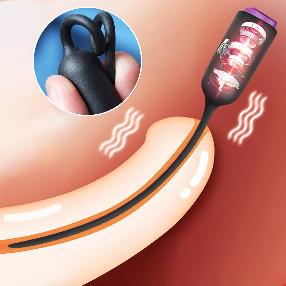 Single Frequency Dilators Urethral อวัยวะเพศชายสั่นใส่ Horse Eye Stick Dilator Masturbation ชายเพศของเล่นสำหรับผู้ชาย